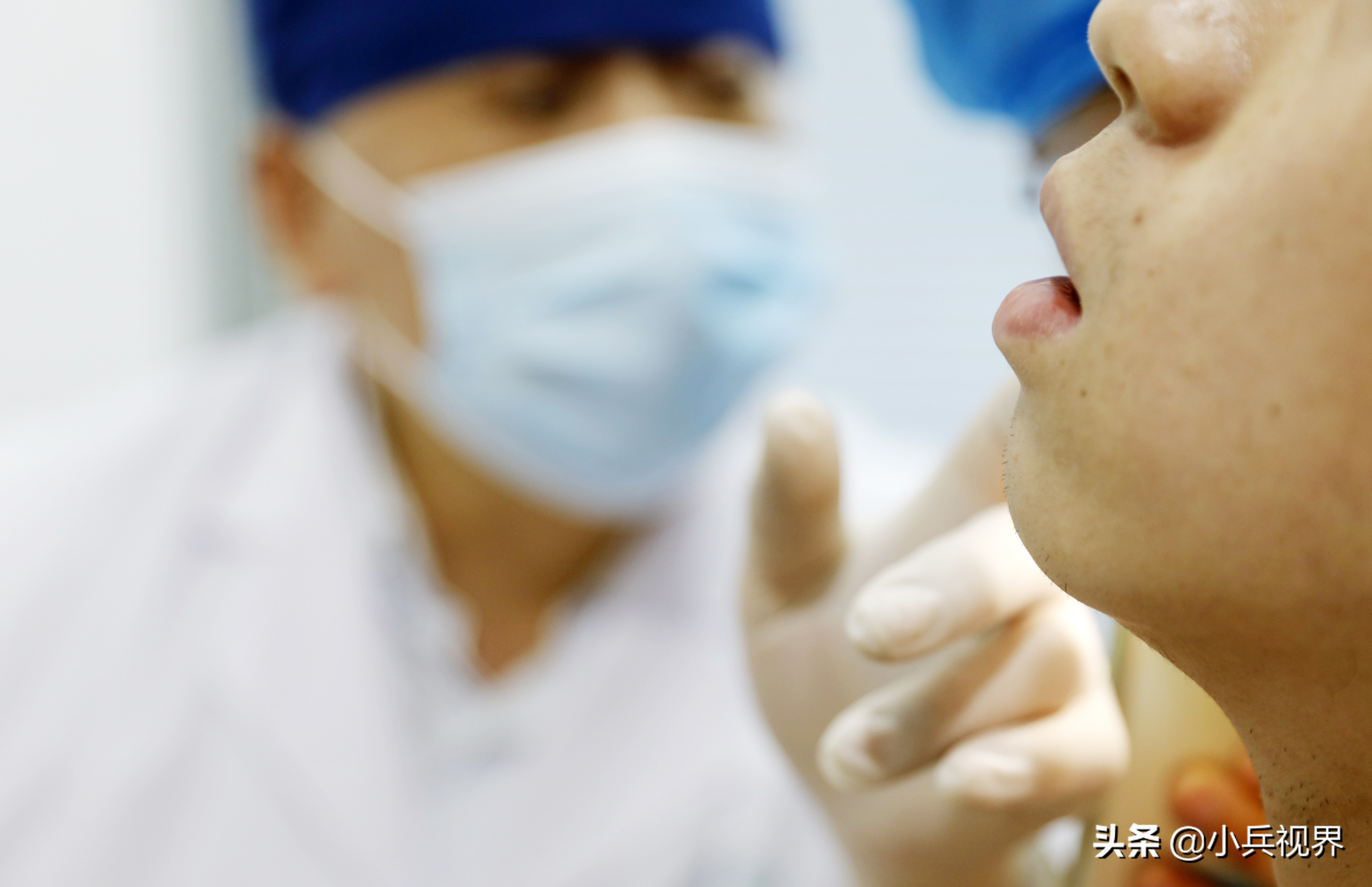 专治皮肤病疑难杂症的老中医,从医40年专治一种病