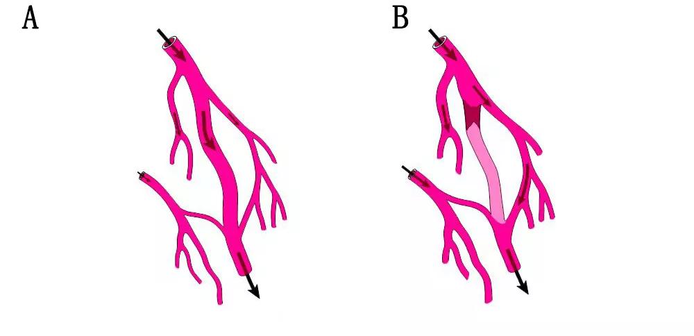 怎样判断脑血管侧支循环是否良好,有勇有谋是优点吗