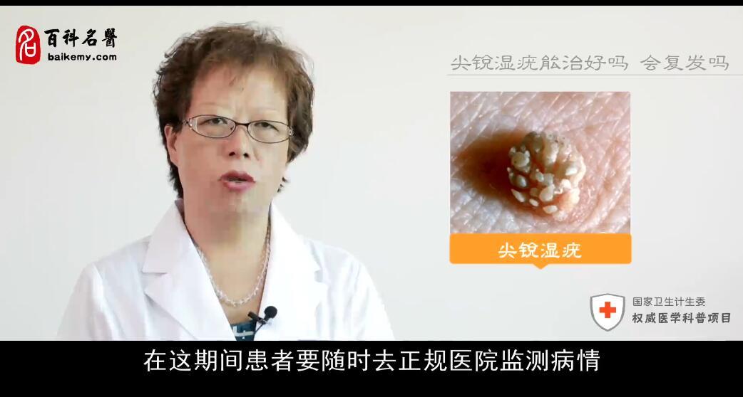 尖锐湿疣是否容易复发？