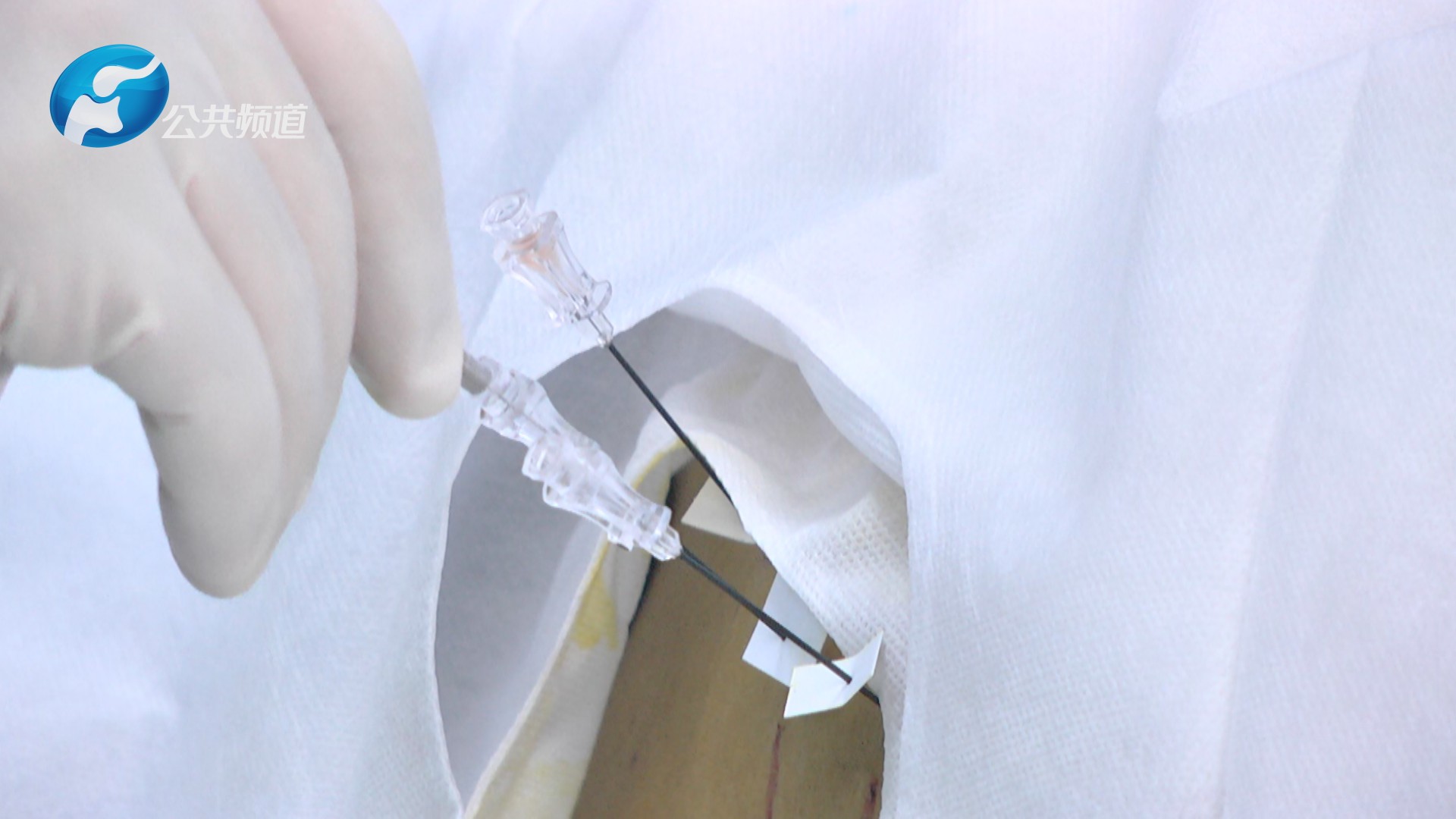 最心疼你的人是我：河南省肿瘤医院疼痛科副主任谢广伦博士