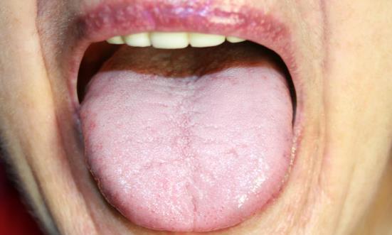 湿气重的6个表现希望你没有,湿气重一招教你轻松解决湿气问题