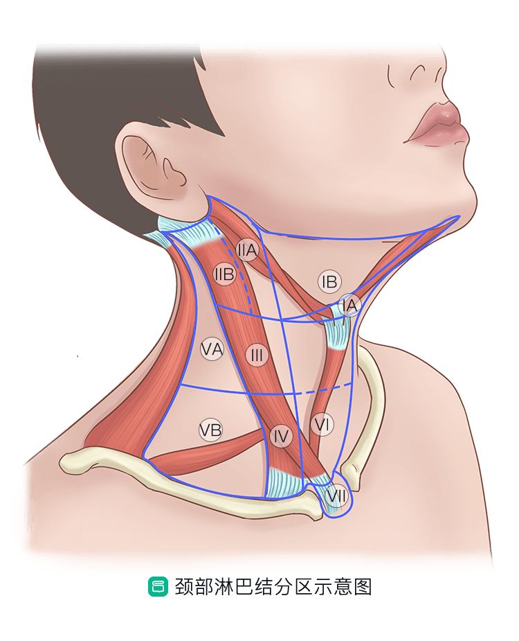 甲状腺癌手术后复发治疗方法,甲状腺癌术后什么情况下容易复发