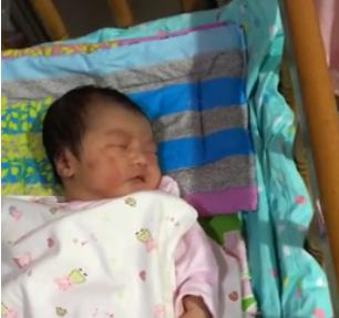 产钳孩子是不是一定有后遗症,产钳夹的印多久可以消失