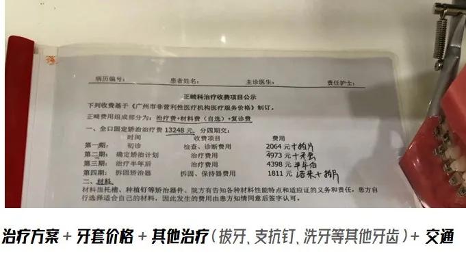 24岁戴牙套还能改善嘴凸吗,24岁戴牙套要戴多久保持器