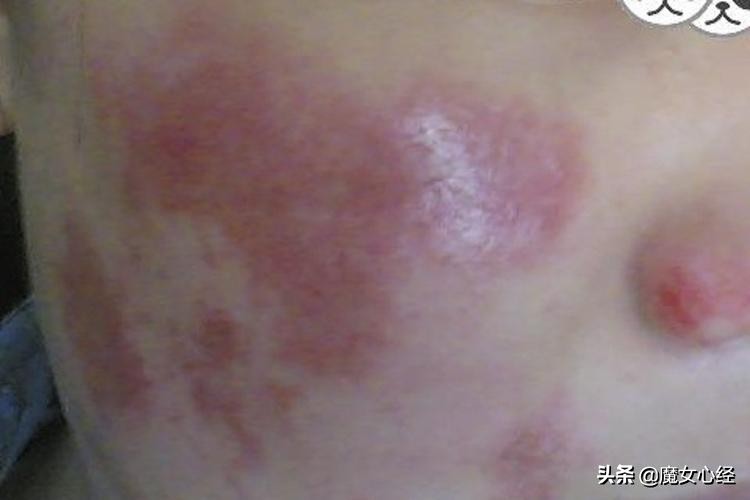 这样使用A醇产品，既能抗皱淡纹，又不伤害皮肤