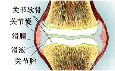 膝关节炎打玻璃酸钠贵吗,膝关节炎打玻璃酸钠