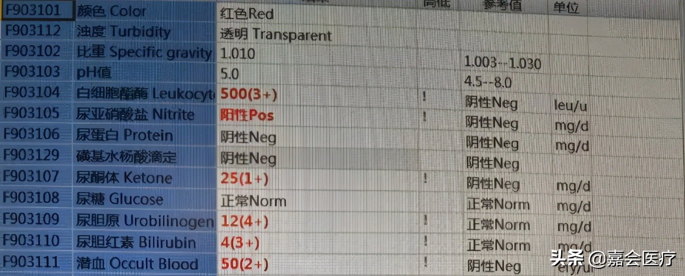 尿液突然变红、变绿？注意这些常见药会改变尿液颜色