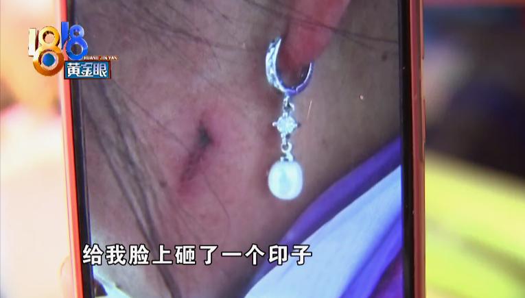 上门讨钱还被人打,上门要钱被打还手算谁的责任