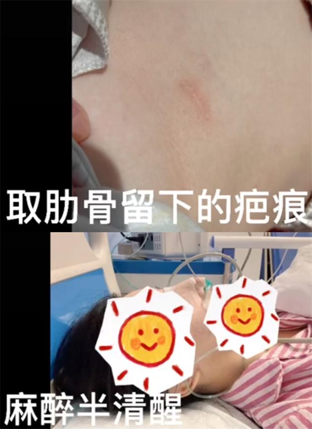 千万网红整容,女子整容失败变巫婆鼻