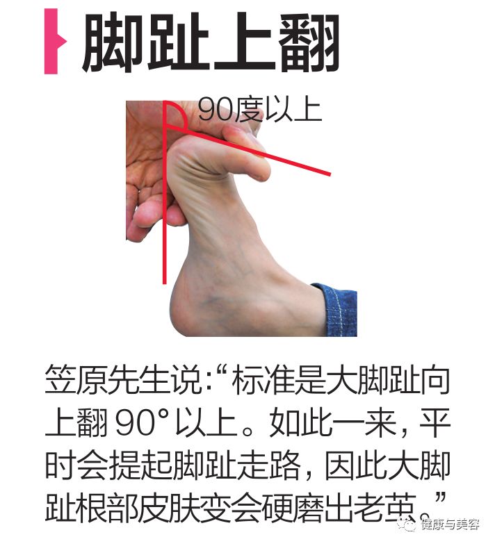 黄晓明谈身高被攻击,黄晓明的脚是如何康复的