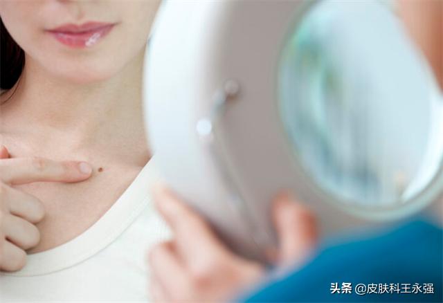 脖子上长小肉粒是已经感染hpv了吗,脖子上长丝状疣是什么病毒感染