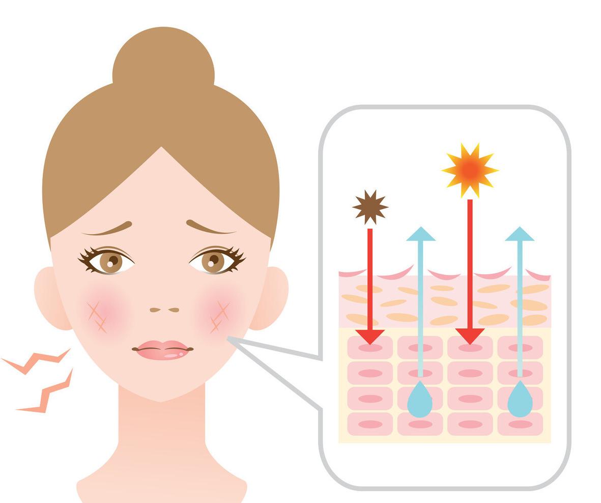 皮肤出现红血丝什么原因,皮肤有红血丝缺什么