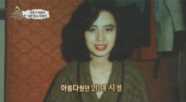 50岁女性整容后续,50岁女人突然整容