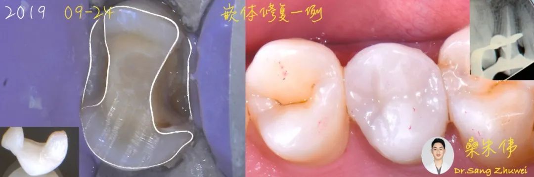 从小白到资深大咖,从小白到大师的蜕变