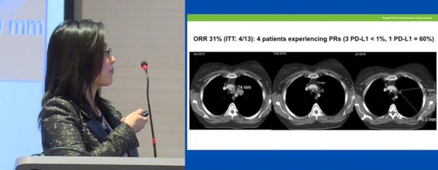 癌症疫苗最新研发消息,癌症疫苗或将问世