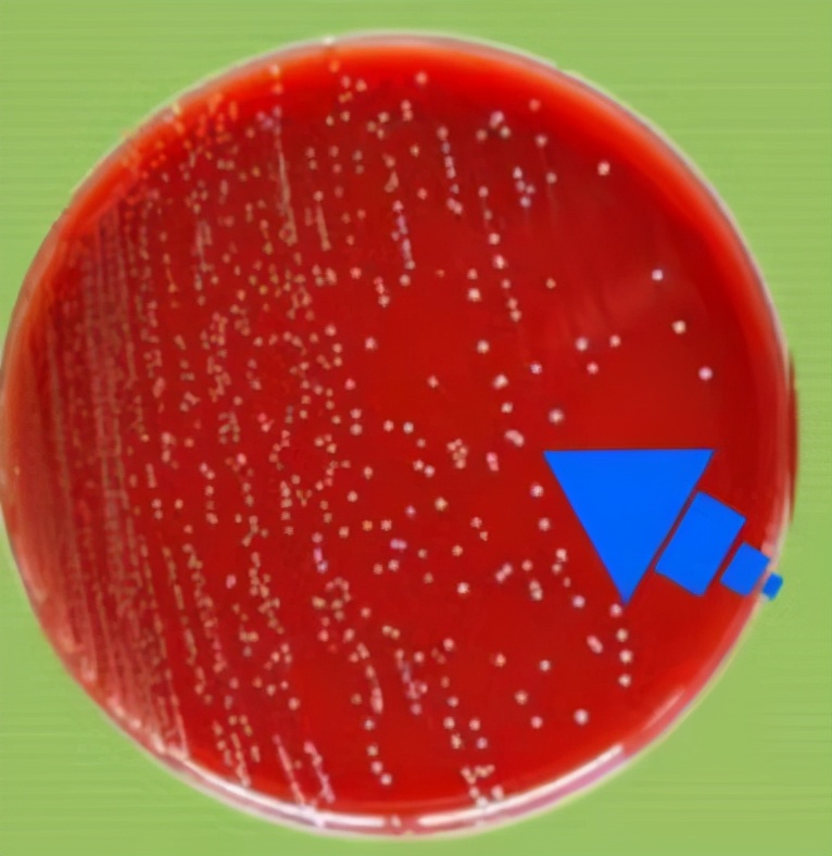 快要做妈妈的你,无乳链球菌筛查做了吗?