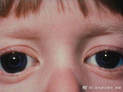 眼科护理手册最新版,眼底病科普手册