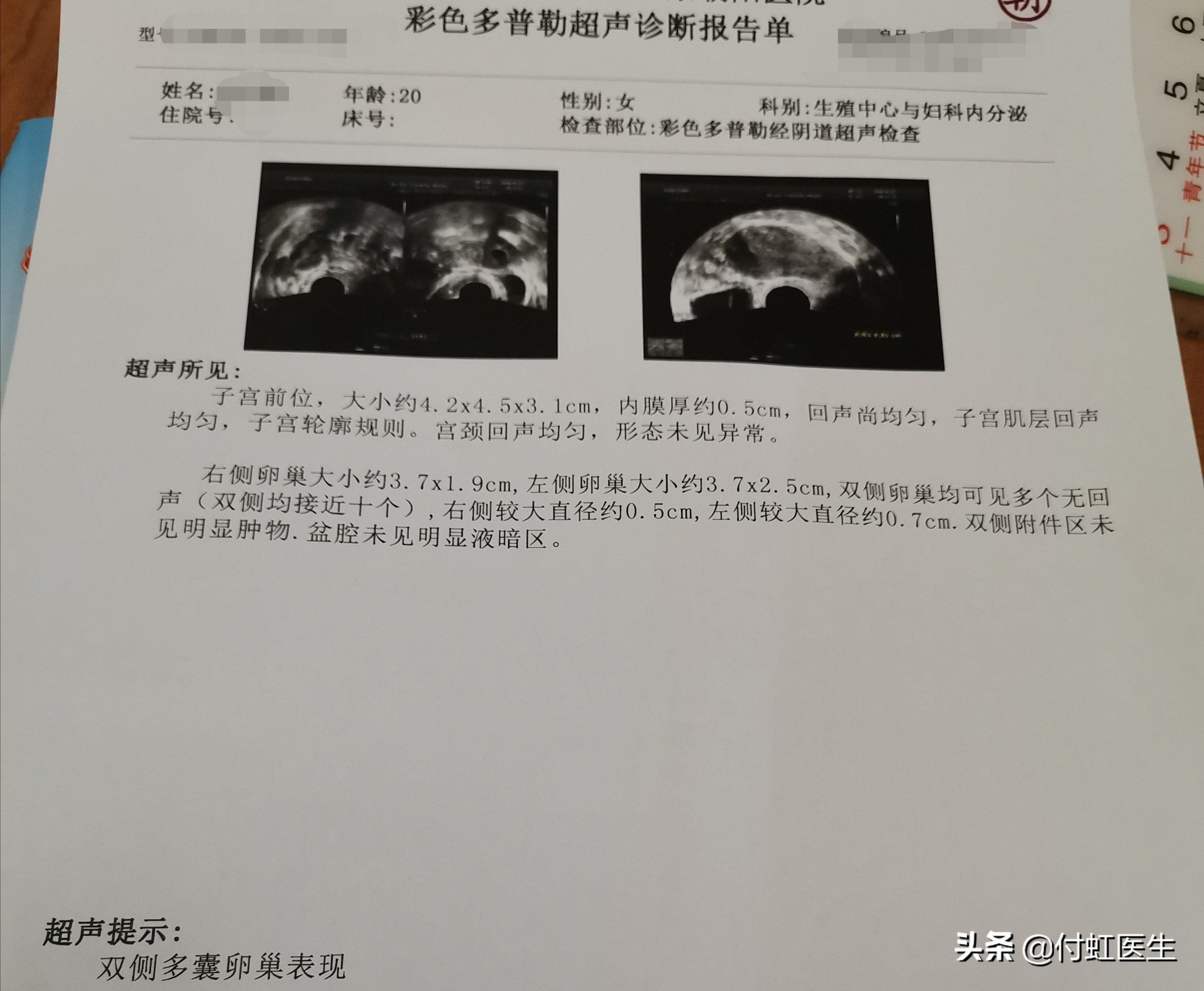 20岁天天吃药调经,50岁用药调经后月经提前八天