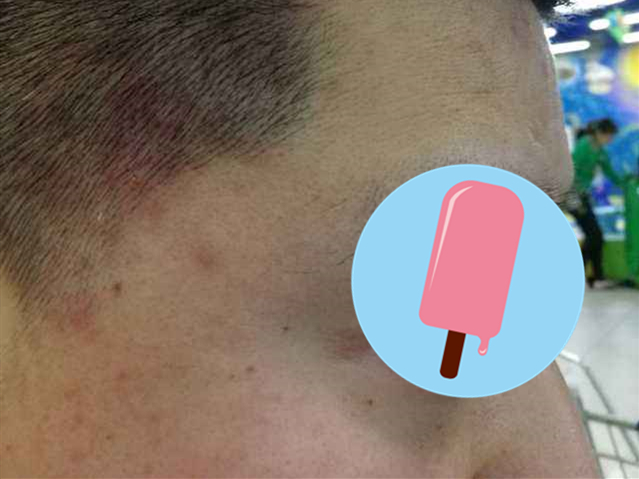 皮肤科医生经典小故事,皮肤科病例故事