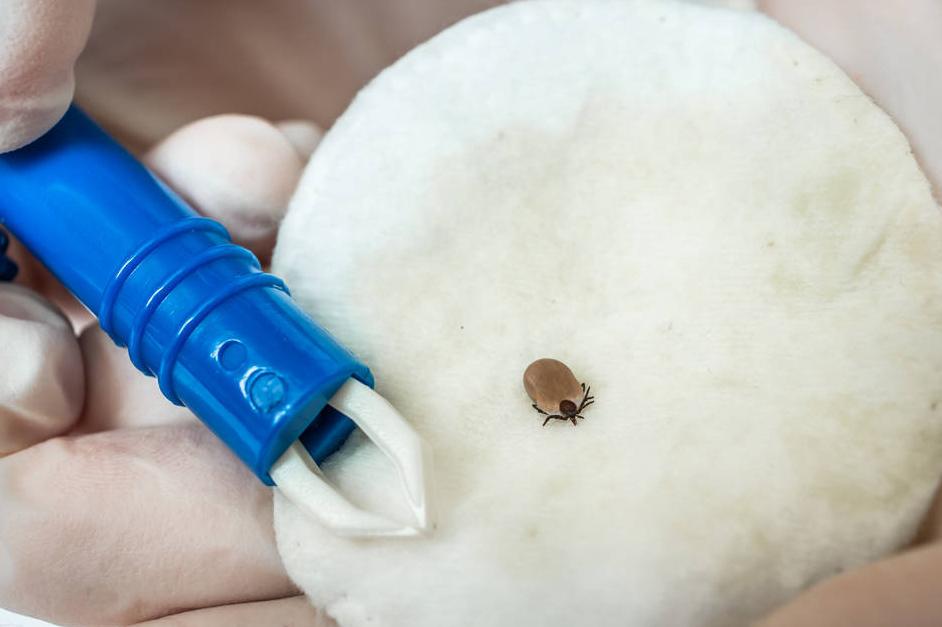 蜱虫咬到孩子之后会出现什么症状,蜱虫虽小危害大一旦被咬如何处置