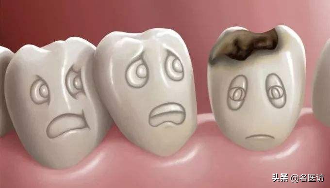 看完牙不用怕，拔牙+洗牙+根管治疗+种植牙+正畸大全在这里