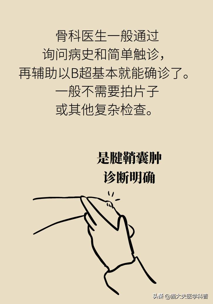 手腕长腱鞘囊肿,手腕上有个凸起的包腱鞘囊肿