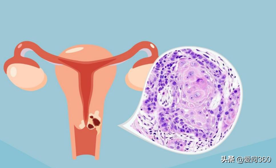 妇科炎症是不是不注意清洁,妇科不注意卫生会引发什么