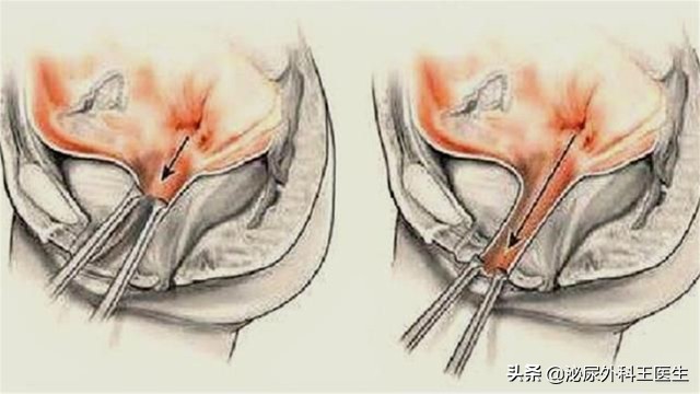 结婚才发现老婆是石女,结婚一年后妻子崩溃