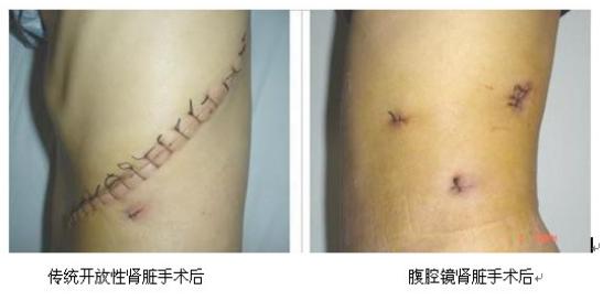 山东治疗泌尿外科比较好的医院,山东大学附属医院泌尿外科专家