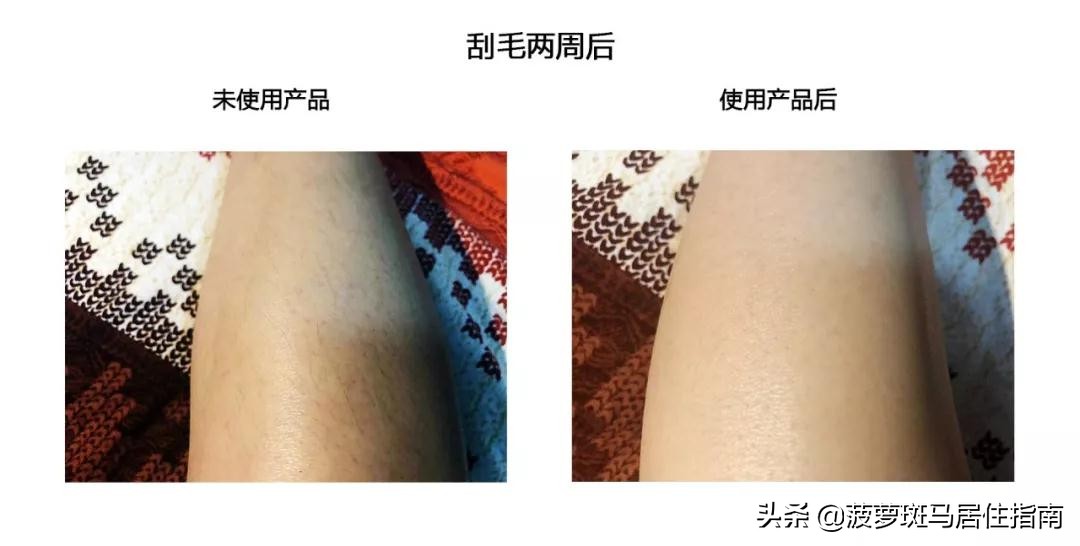 最简单的脱毛大法,推荐5个脱毛方法