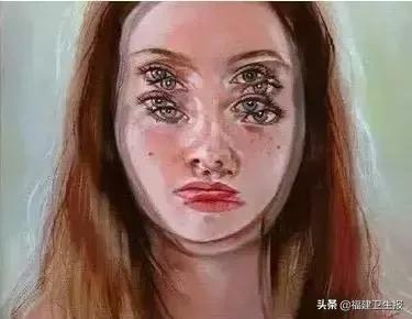 福州6岁男童散光400多度，医生让他每天玩iPad游戏？！原因是…