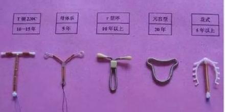 60多岁了取环要住院吗,60岁取环必须宫腔镜吗