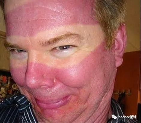 为什么老特的眼袋是白色的？