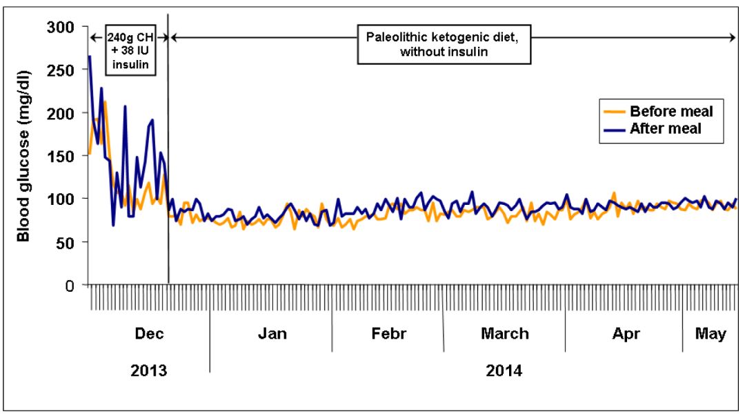 国外1型糖尿病竟奇迹的康复了,年轻人得一型糖尿病有可能痊愈吗