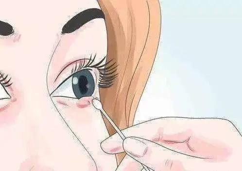 长针眼怎么快速解决民间偏方,长针眼民间的治疗方法