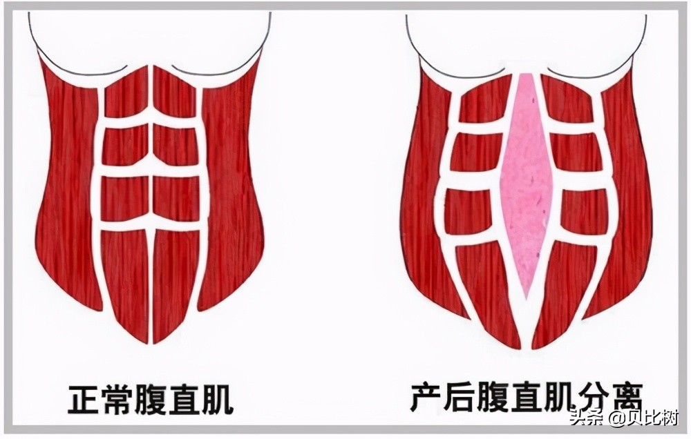别被明星产后模样忽悠了!这才是最伟大的母亲生产后的真实模样