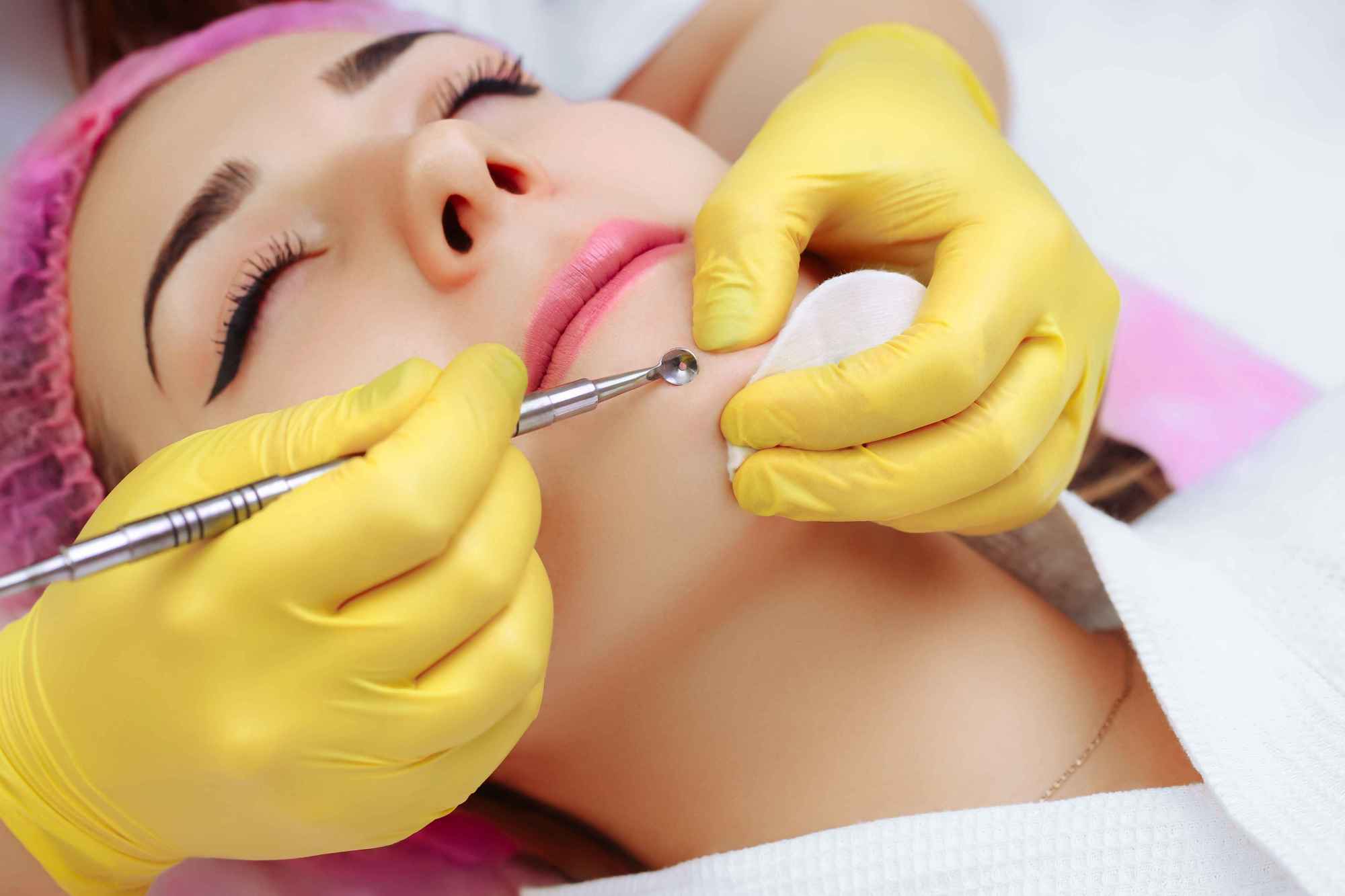 脂肪瘤怎么预防和注意事项,脂肪瘤预防和注意事项