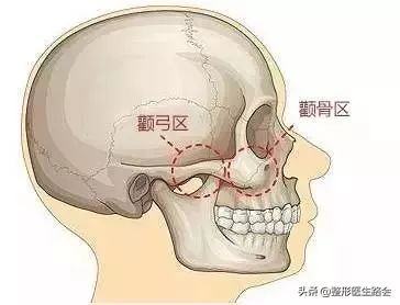 颧骨很突的人性格很奇怪,为啥有人觉得你凶