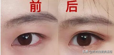 眼睛变大的方法用五天,眼睛变大有方法吗