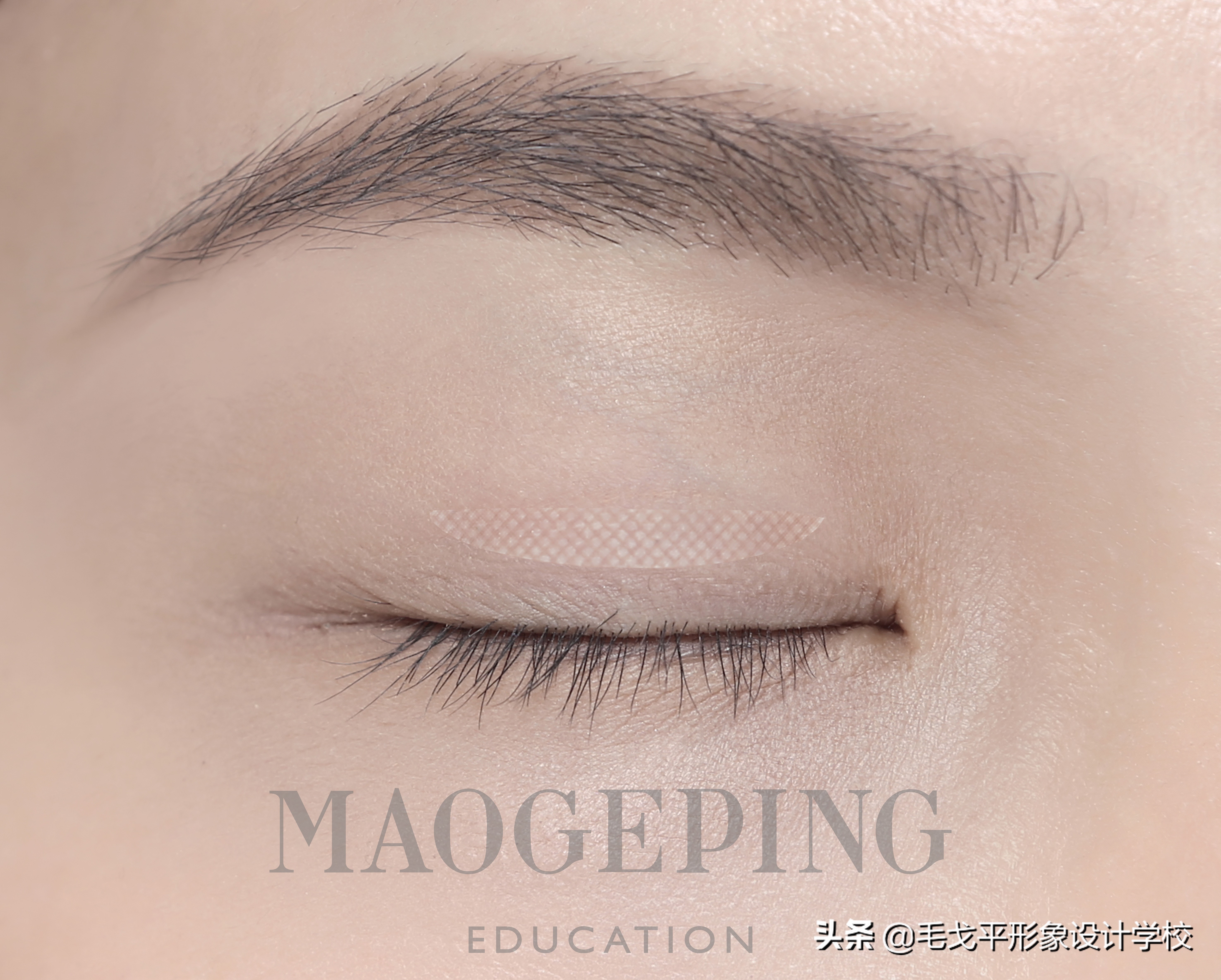 单眼皮肿眼泡正确贴法教程,单眼皮肿眼泡怎么贴双眼皮