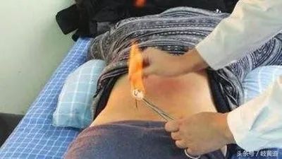 为何今年得带状疱疹得特别多,健康人群带状疱疹感染率