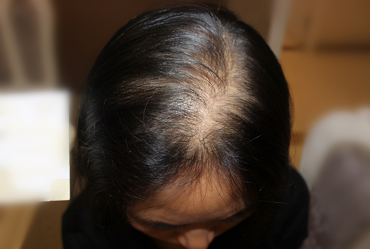 缺乏深度睡眠的5大征兆,睡眠易醒缺少深度睡眠