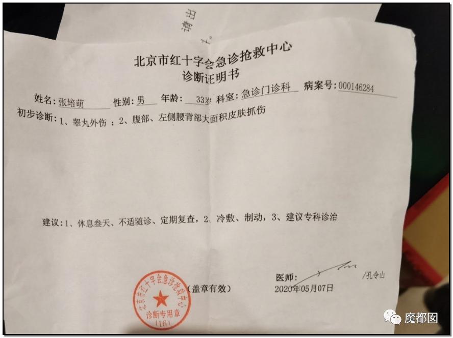 短跑名将张培萌家暴事件,短跑名将张培萌被控家暴