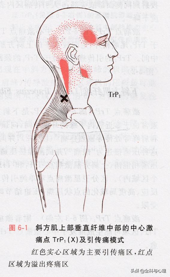 中医如何治疗肩峰损伤,中医治疗软组织损伤案例方剂