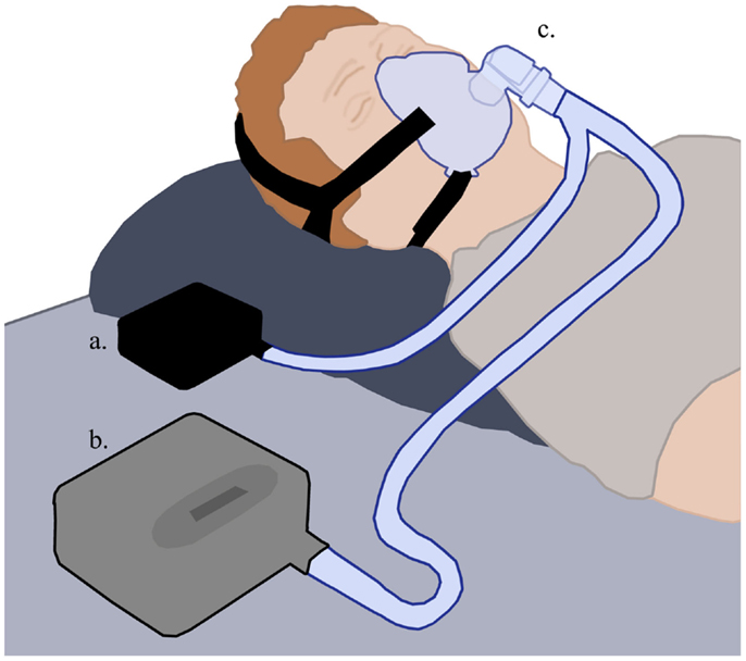 睡觉打呼噜憋住了,打呼噜把自己憋醒对身体有伤害吗