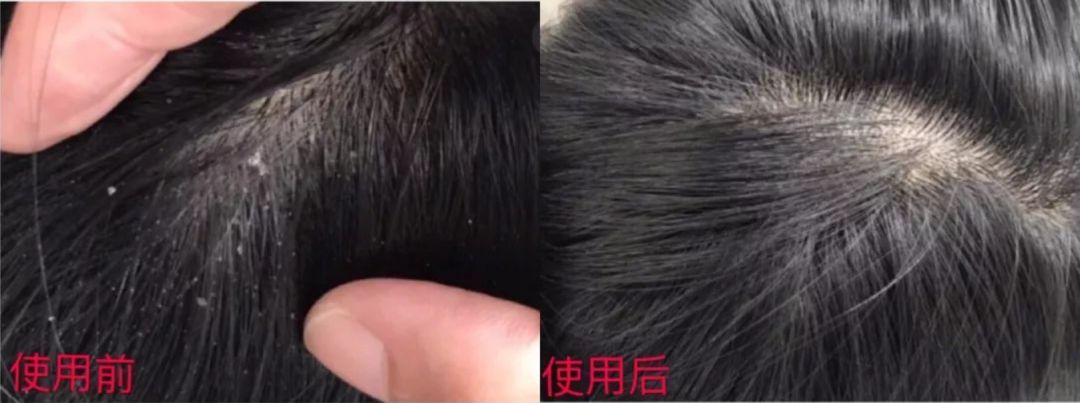 明星亲测|康王创始人83岁再出山，挑战5天内不洗头