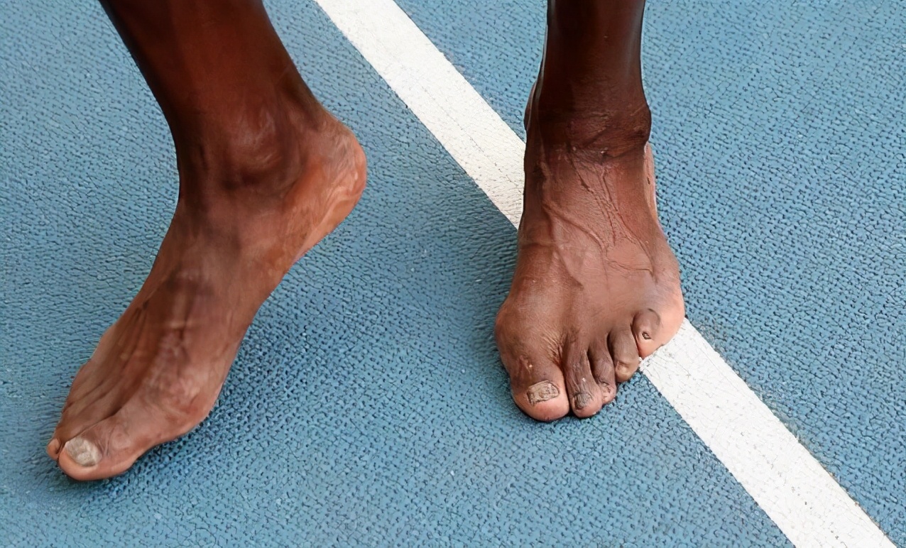 博尔特为什么会消失,博尔特为啥右腿起跑