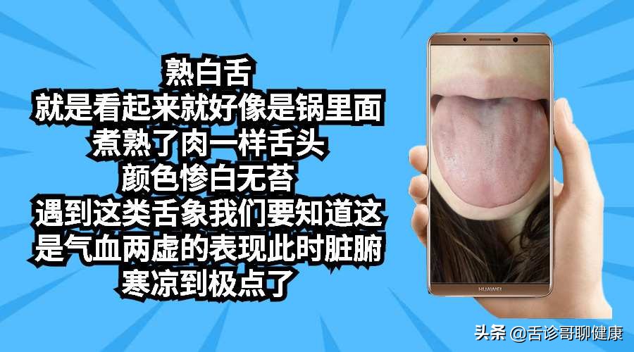 舌诊哥:遗精滑精、气短、虚汗、紧张、焦虑等舌象分析