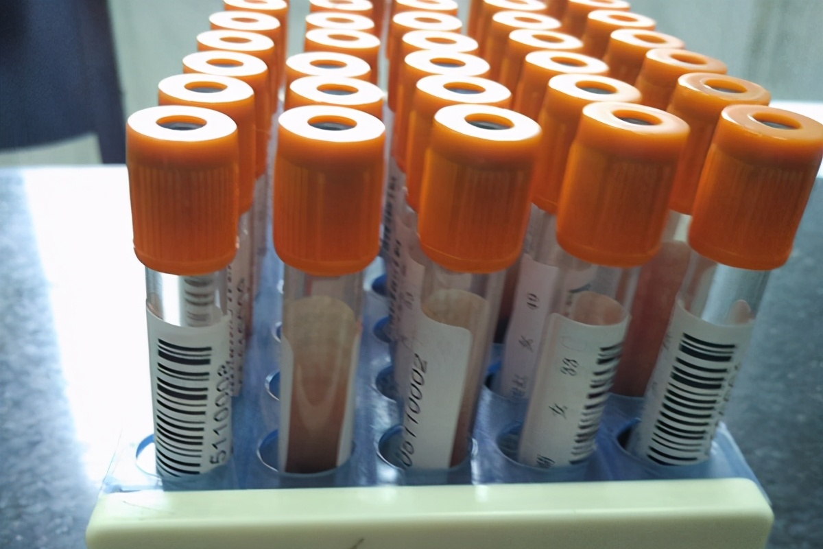 医院领的叶酸和药店的叶酸哪个好,为什么医院的叶酸片便宜