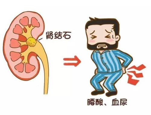 通过痛的位置（肚子、小腹、腰部），来给自己看病